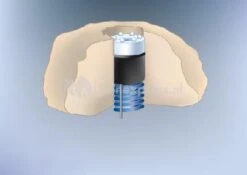 3 LED-LIGHTS Met Vervangbare LED Krans 11 3 LED-LIGHTS Met Vervangbare LED Krans -Goedkope Droom Vijver Winkel 3 led lights met vervangbare ledkopjes 0 400x283 1