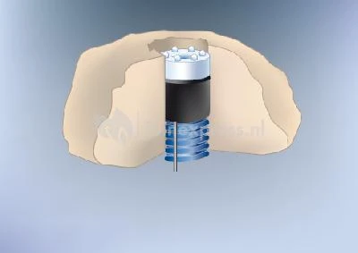 3 LED-LIGHTS Met Vervangbare LED Krans 6 3 LED-LIGHTS Met Vervangbare LED Krans - Afbeelding 4